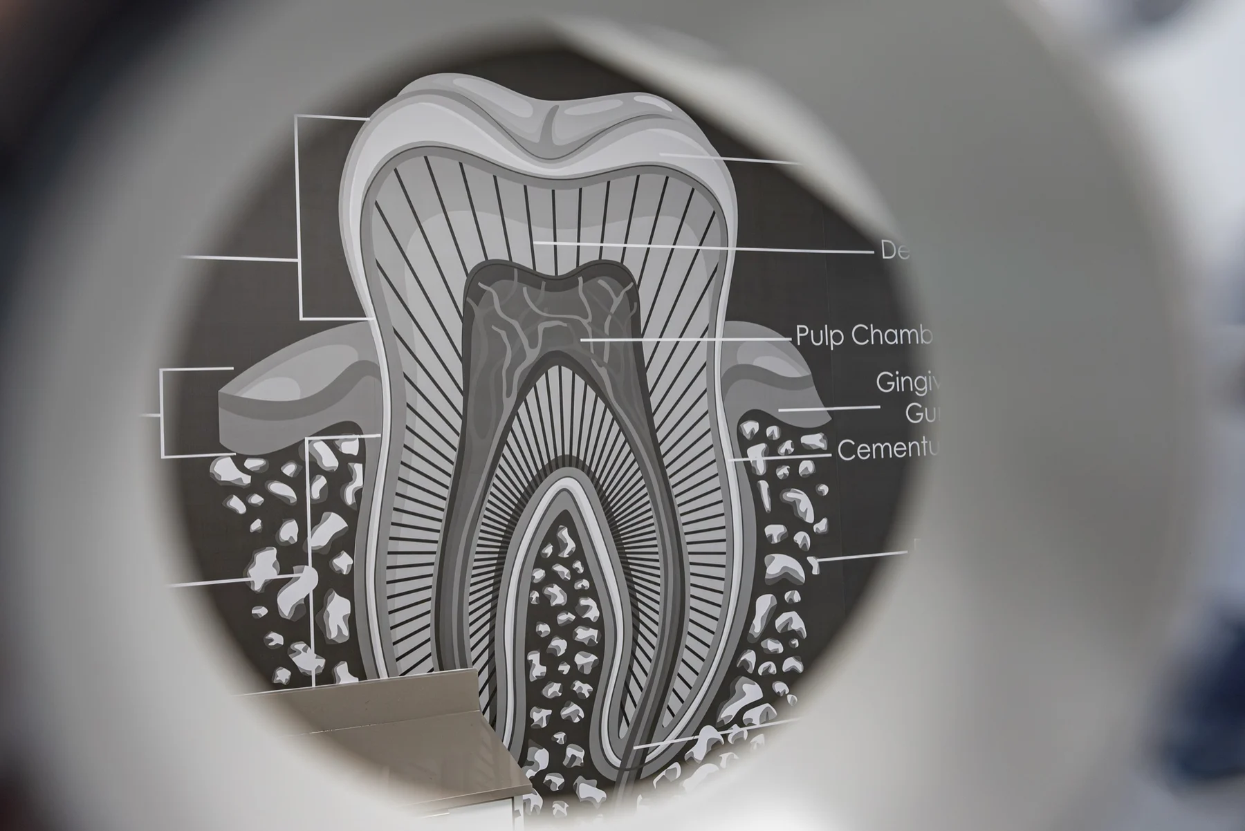 Anillo Dentistry — The tooth anatomy graphic seen through a dental magnifying lens