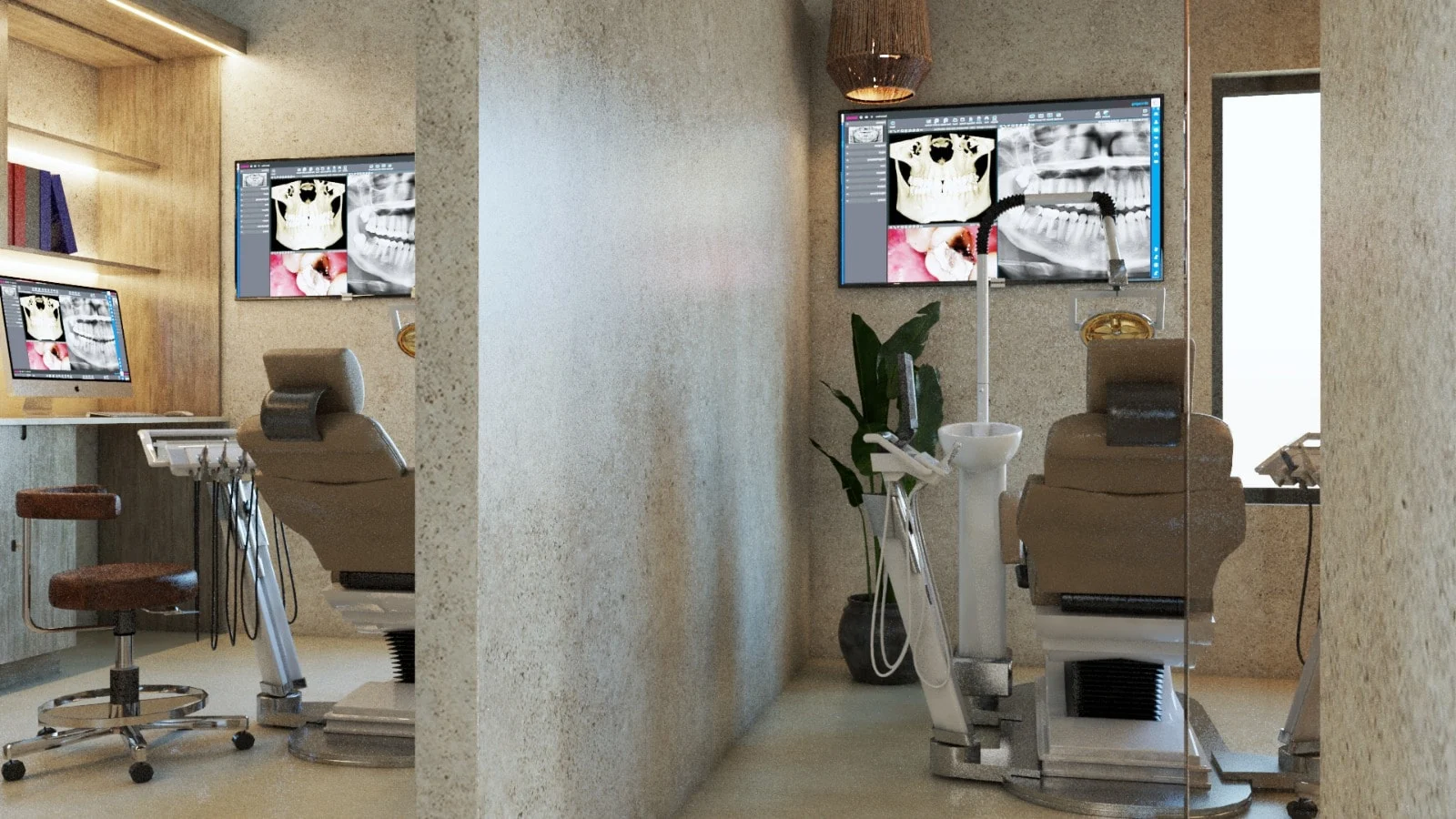 SDC — Smile Dental Center — Two treatment rooms split by a stone-look wall, each with a dental chair and a screen showing X-rays